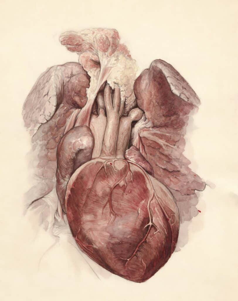 Christopher Mallavarapu Cardiac