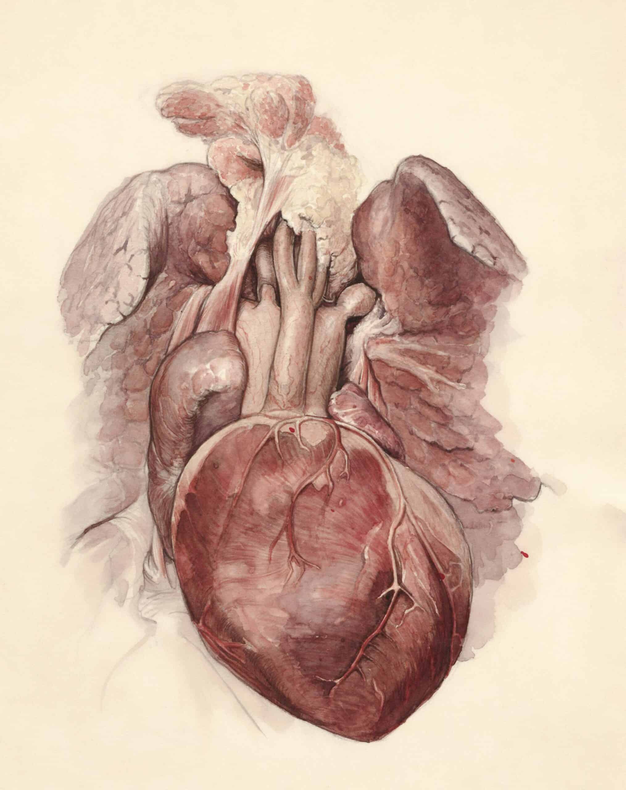 Christopher Mallavarapu Cardiac